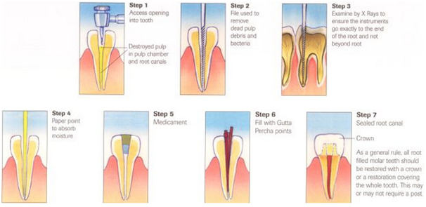 Best Dental Clinic in Bangalore