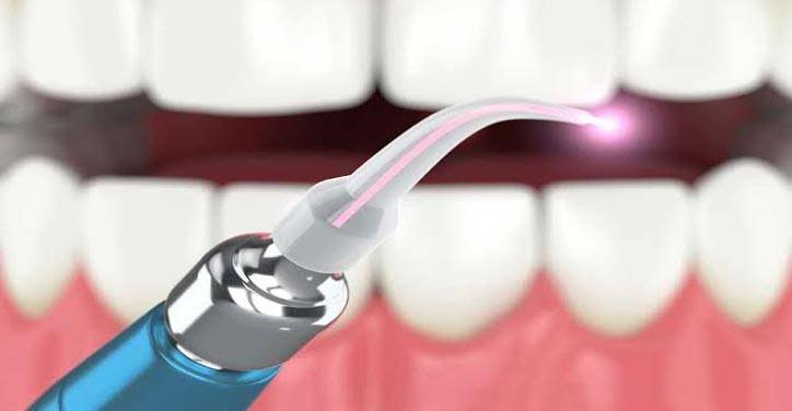 Best Dental Clinic in Bangalore