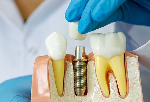 Best Dental Clinic in Bangalore