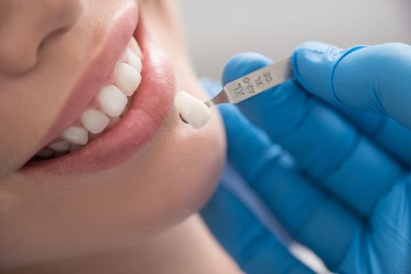 Best Dental Clinic in Bangalore