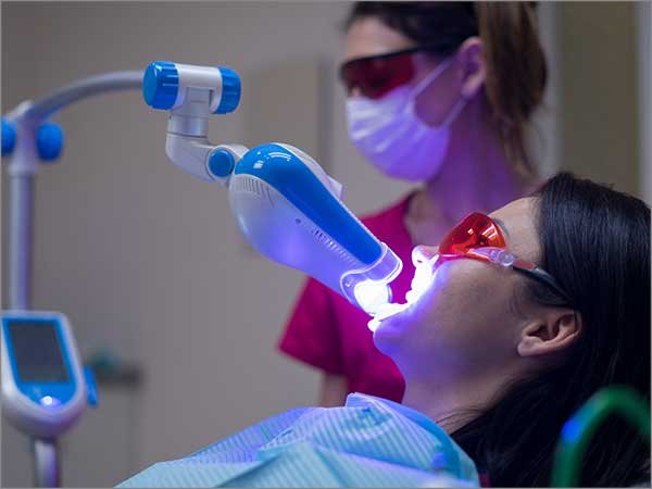 best laser teeth whitening in Bangalore