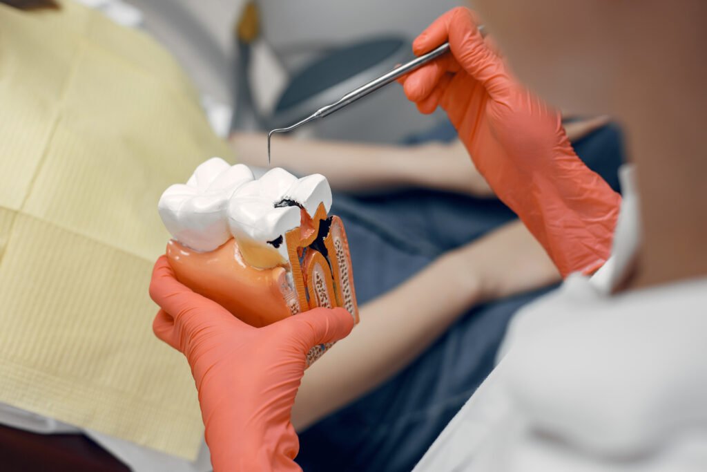 best cavity treatment in Bangalore