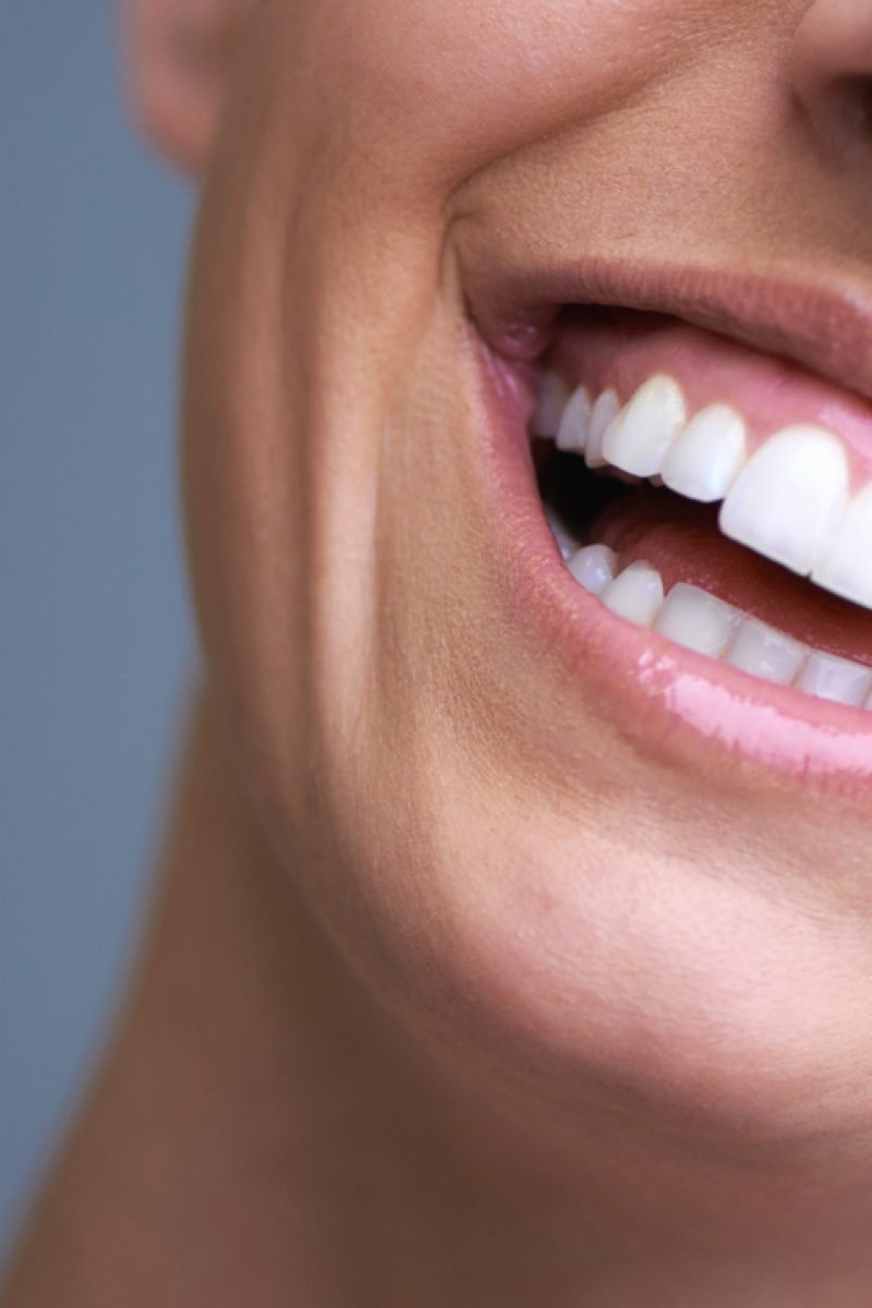 Best Dental Clinic in Bangalore